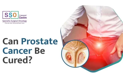 Can Prostate Cancer Be Cured? Treatment and Prognosis